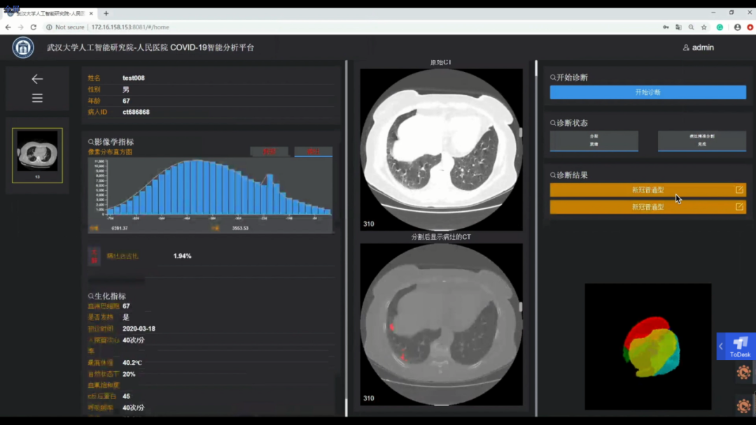 ▲COVID-19智能分析平台的界面