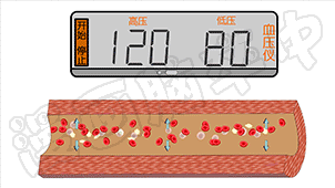血压越高，对血管的冲击越大。图源：微信公众号“漫画脑卒中”。