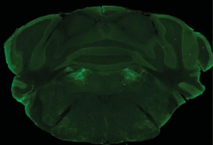 ▲这是一张小鼠的大脑切片，这群特殊的神经元位于大脑深部，图中亮绿色显示的区域（图片来源：参考资料[2]；Credit: Rong Gong）