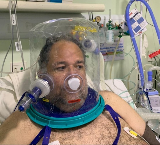△新冠肺炎患者使用头戴式呼吸辅助机器 来源：巴西环球传媒集团