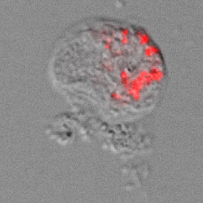 与肺部变形虫有关的新细菌被发现 受精灵球启发而命名“Pokemonas”