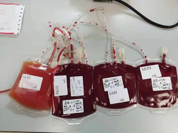 图说:事先已分离的悬浮红细胞 采访对象供 图(下同)