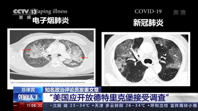 菲律宾知名政治评论员：美国应开放德特里克堡接受调查