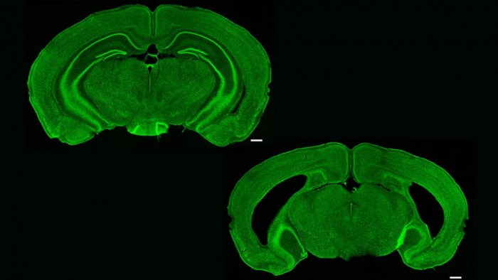 研究人员研究小鼠大脑以了解记忆中心的情况