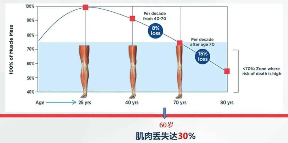 "与增龄相关的进行性,全身肌量减少/或肌强度下降或肌肉生理功能减退"