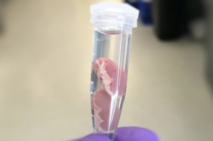 科学家开发血管涂层 有望减少移植器官的排斥反应 1 科学家开发血管涂层 有望减少移植器官的排斥反应
