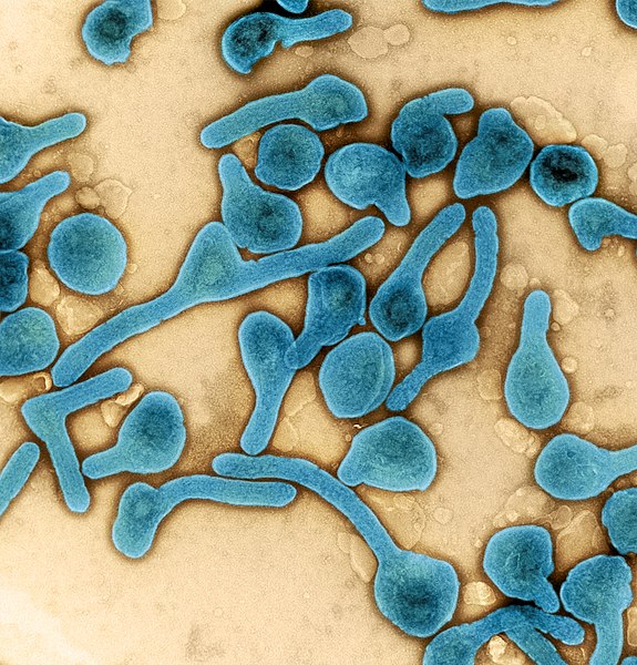 几内亚出现首例马尔堡病毒死亡病例  传播方式类似埃博拉