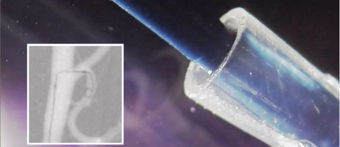 科学家开发首个用于脑部手术的“可操纵”导管 3 科学家开发首个用于脑部手术的“可操纵”导管