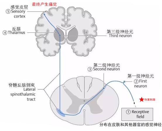 c臂怎么启动人类高质量疼痛“消失”法_https://www.jmylbn.com_新闻资讯_第3张