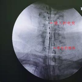 c臂怎么启动人类高质量疼痛“消失”法_https://www.jmylbn.com_新闻资讯_第8张