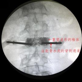 c臂怎么启动人类高质量疼痛“消失”法_https://www.jmylbn.com_新闻资讯_第7张