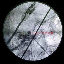 c臂怎么启动人类高质量疼痛“消失”法_https://www.jmylbn.com_新闻资讯_第9张