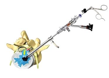 c臂怎么启动人类高质量疼痛“消失”法_https://www.jmylbn.com_新闻资讯_第6张