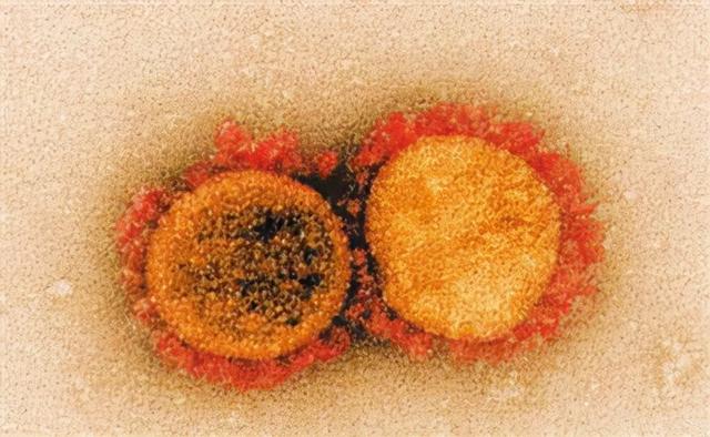 研究接种新冠疫苗也能预防其他冠状病毒