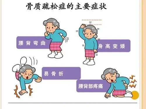 世界骨质疏松日让你更有骨气