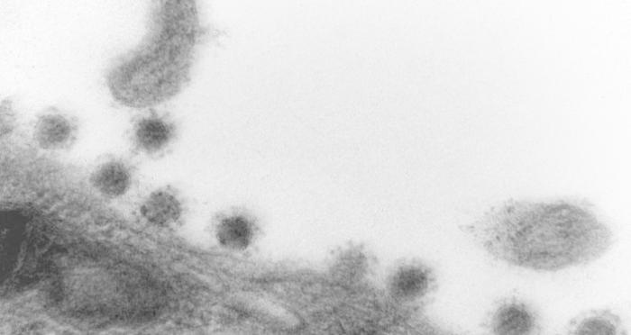 新冠变异病毒“德尔塔”毒株。图片来源：俄罗斯“矢量”病毒学与生物技术国家科学中心。