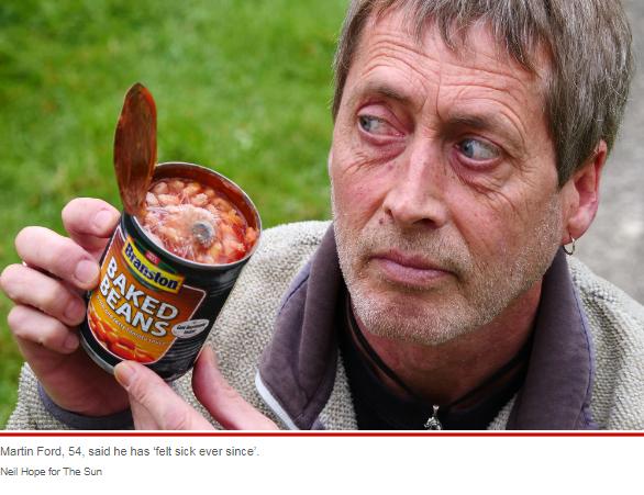 英国男子在罐头中吃出“眼球” 图源：外媒