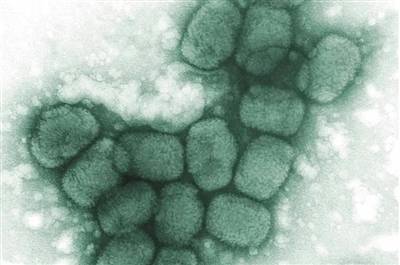 图为1975年美国CDC提供的显微镜下的一组天花病毒。