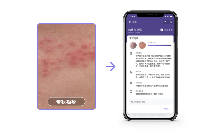 覆盖99%皮肤自然发病率，这家公司的AI辅诊已被调用近1000万次