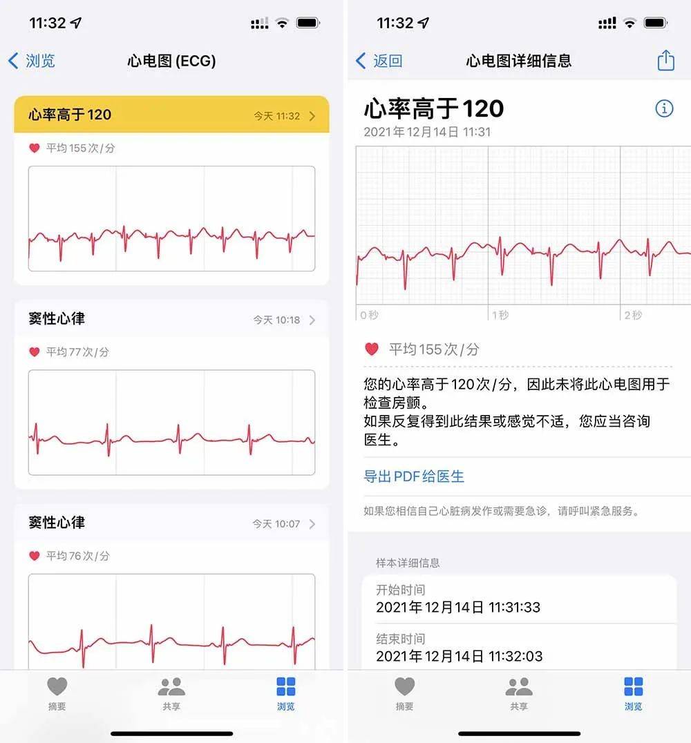 首先我们要明确,apple watch 测量的心电图并不能用作心脏病等疾病的