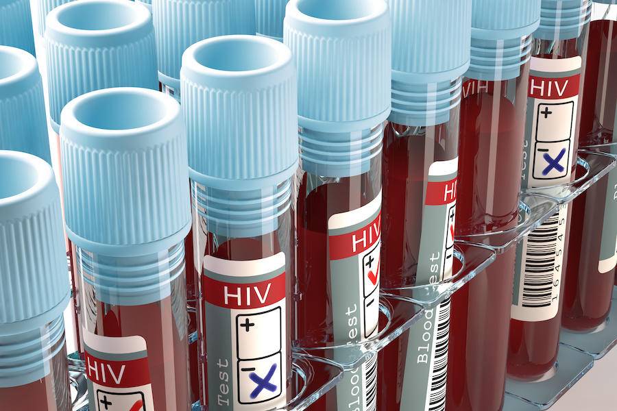 FDA批准HIV首款长效注射疗法，一月只需一次治疗