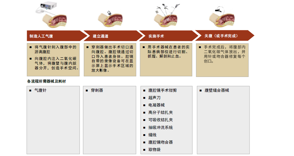 为什么手术会用到结扎夹中金：高需求下，国产硬镜有望开启放量_https://www.jmylbn.com_新闻资讯_第5张