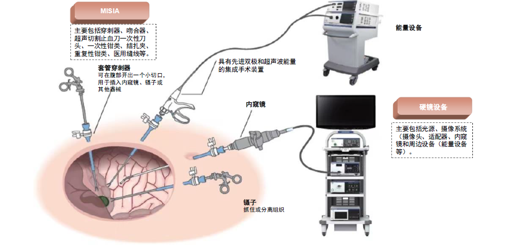 为什么手术会用到结扎夹中金：高需求下，国产硬镜有望开启放量_https://www.jmylbn.com_新闻资讯_第4张