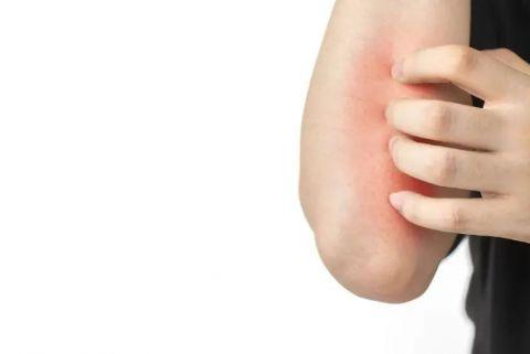 男子常常半夜突然醒来全身奇痒无比元凶竟是它这习惯很多人都有