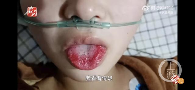 夜读18岁女孩被姐夫投毒百草枯人民日报评论眯眯眼争议事件