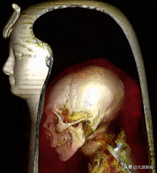 ct扫描3500年前埃及法老木乃伊内脏被盗大脑和心脏还在