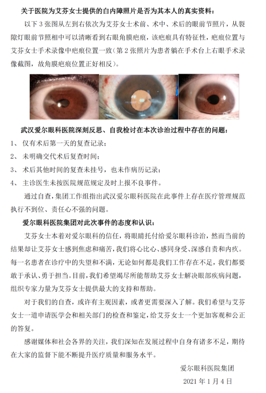 ↑针对艾芬对爱尔眼科提供虚假白内障照片的质疑,爱尔眼科列出了三张术前、术中、术后的眼前节照片。艾芬向红星新闻表示,这三张照片之前她并没有看到过