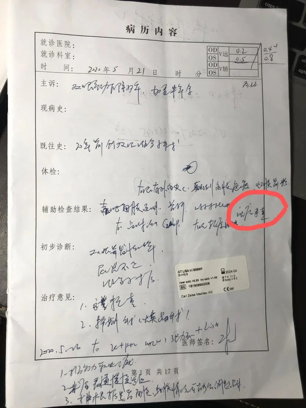 艾芬在爱尔眼科的门诊记录,红圈处为"眼底未查".图片来源:艾芬