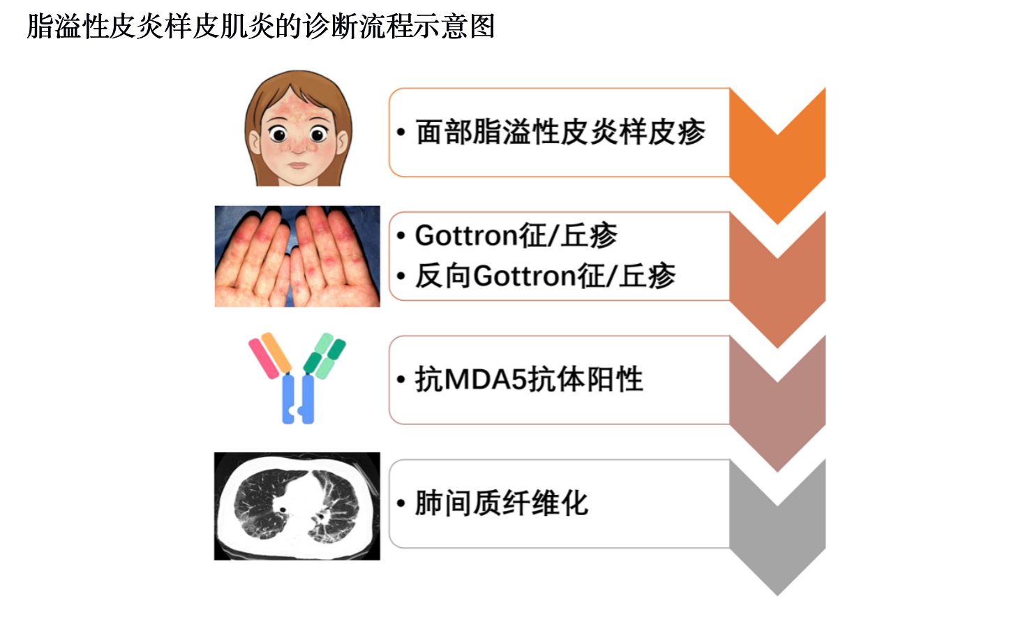 上海专家发现特殊类型皮肌炎——脂溢性皮炎样皮肌炎