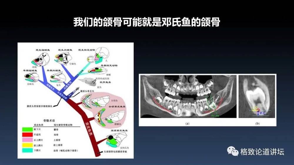 虽然我们和邓氏鱼没有直接的亲缘关系,但是我们的很多身体结构可以