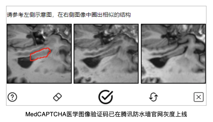 腾讯联合推出首个医学图像验证码，解决医学标注难题