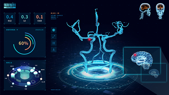 图：U-Pixel脑卒中智能诊疗平台（图片由强联智创®提供）