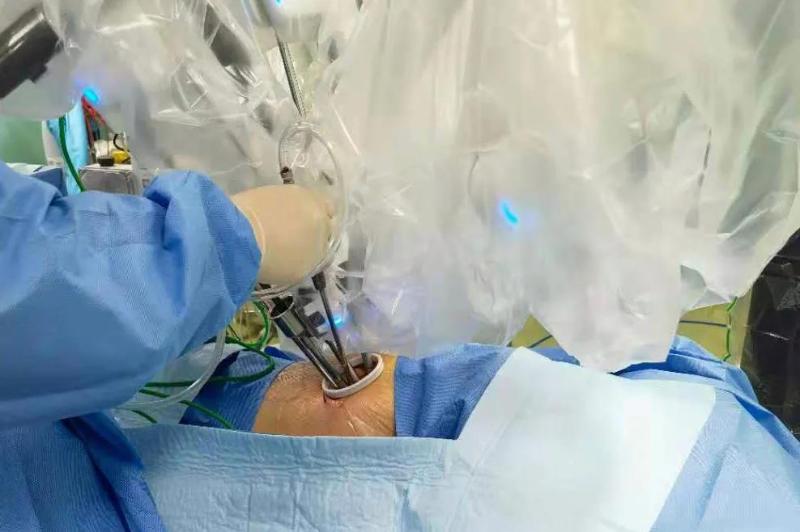 正文  机器人胸部手术将胸外微创手术带入一个新纪元.