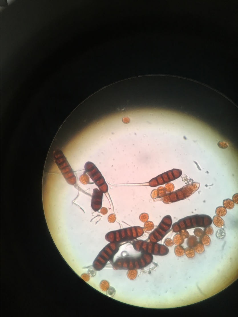 显微镜下的锈菌冬孢子和夏孢子虽是收之东隅,但也失之桑榆.