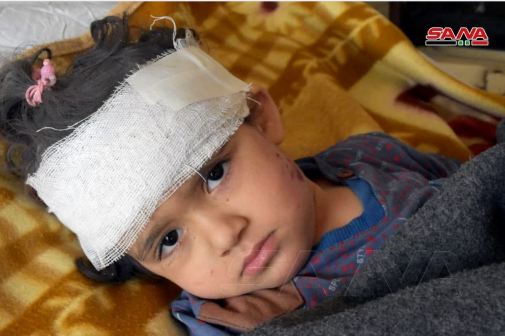 △在今年1月以色列空袭叙利亚哈马省过程中受伤的叙利亚小女孩（图片来自于叙通社）