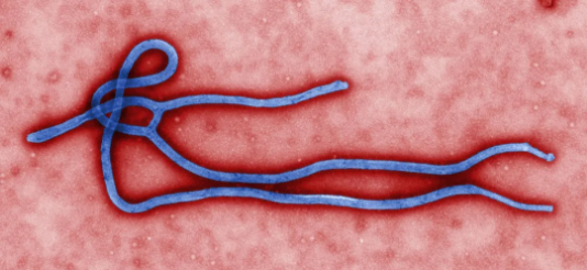 埃博拉病毒的电镜图像（图片来源：CDC/Cynthia Goldsmith）