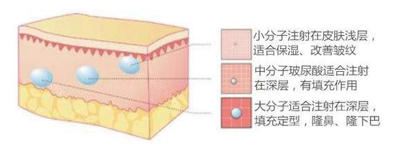 图4：不同分子大小玻尿酸的适用范围，来源好大夫在线官网