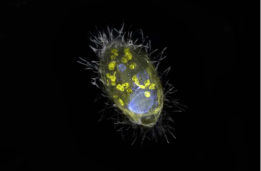 黄色荧光标记了Candidatus Azoamicus ciliaticola，蓝色则是纤毛虫的细胞核与纤毛（图片来源：马克斯·普朗克海洋微生物学研究所）