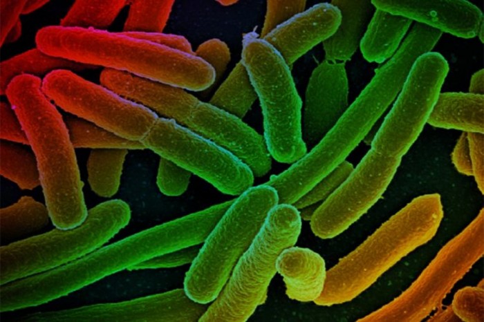 MIT研究称代谢基因突变可帮助细菌抵抗药物治疗