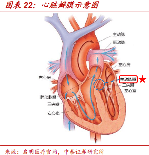 富途研选微创系心通医疗能否领跑心脏瓣膜新赛道