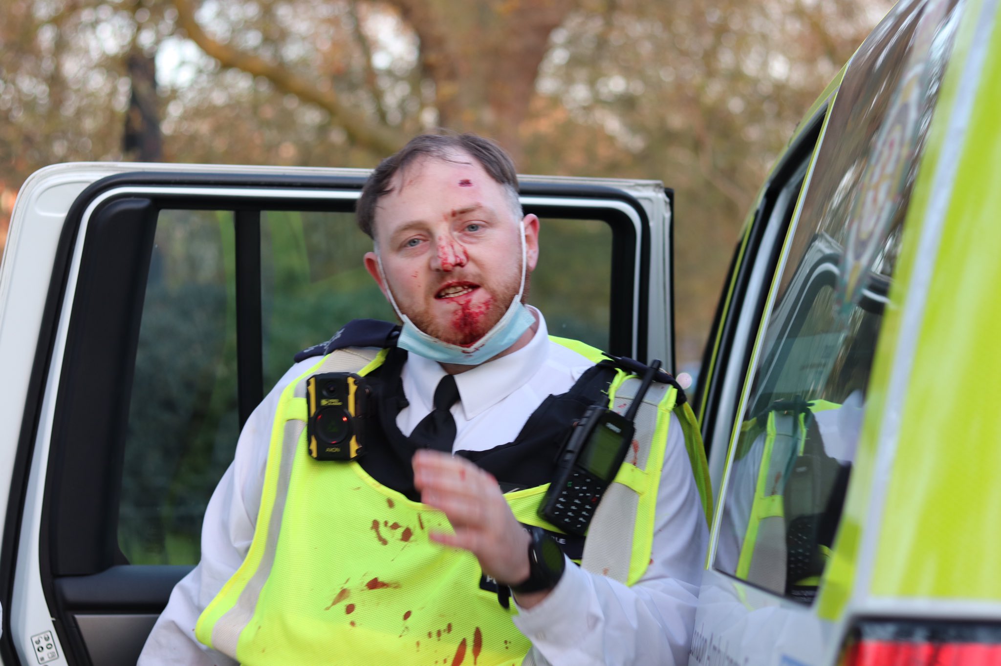 英国爆发反封锁暴力冲突警察头破血流和抗议者扭打一团图