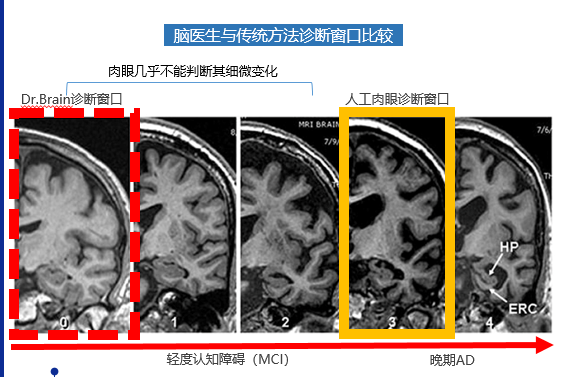 AI医疗热度不减，智能影像的“盘子”到底有多大？