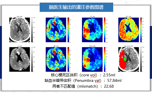 本文文章插图来源于脑医生,经授权使用