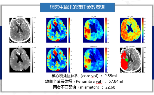 本文文章插图来源于脑医生，经授权使用