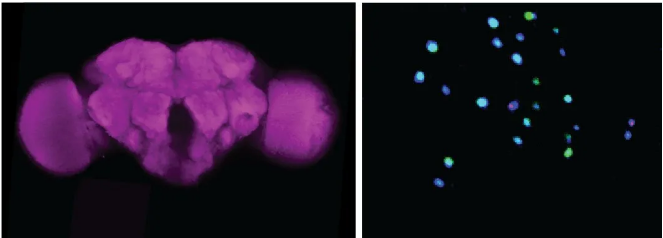 果蝇大脑（左）和果蝇脑组织的细胞核（右）。（图片来源：Joshua Raji and Christopher Potter，Johns Hopkins Medicine）