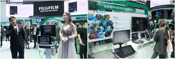 医学胶片怎么处理富士胶片智慧诊疗综合解决方案全新亮相CMEF 2021_https://www.jmylbn.com_新闻资讯_第9张